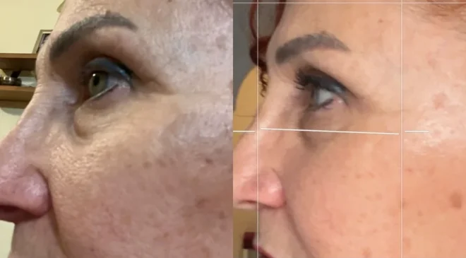 Dokunmadan Gençlik ve Güzellik vaadeden Nuray Kaya ‘Pranic Şifa’ ile Yüz Germe ve Vücut Şekillendirme yapıyor